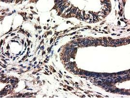 CYB5R3 Antibody in Immunohistochemistry (Paraffin) (IHC (P))