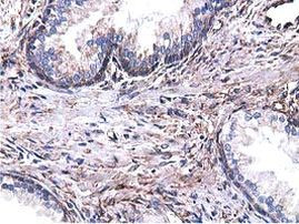 CYB5R3 Antibody in Immunohistochemistry (Paraffin) (IHC (P))