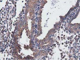 CYB5R3 Antibody in Immunohistochemistry (Paraffin) (IHC (P))