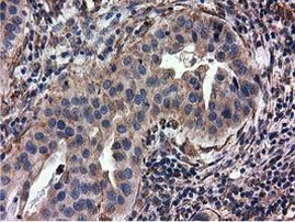 CYB5R3 Antibody in Immunohistochemistry (Paraffin) (IHC (P))