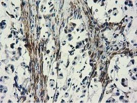 CYB5R3 Antibody in Immunohistochemistry (Paraffin) (IHC (P))