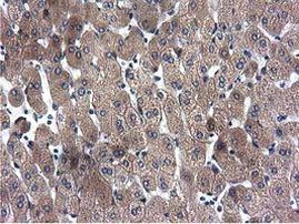 CYB5R3 Antibody in Immunohistochemistry (Paraffin) (IHC (P))