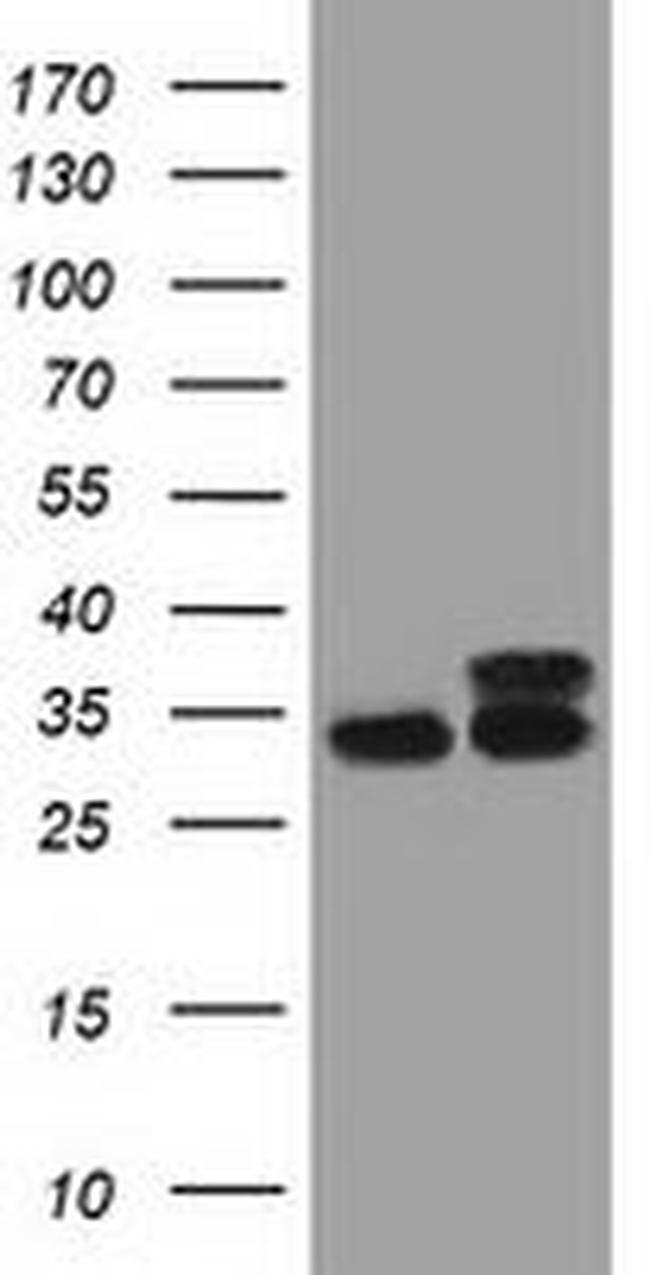 CYB5R3 Antibody in Western Blot (WB)