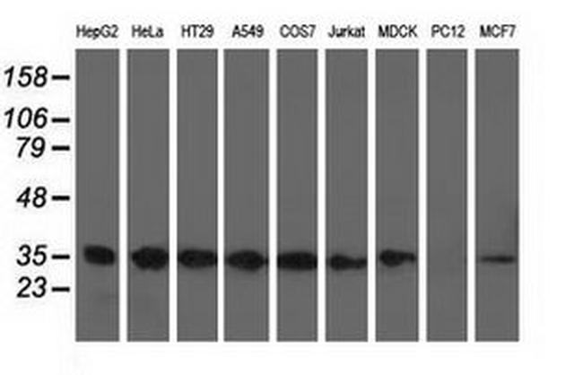 CYB5R3 Antibody in Western Blot (WB)