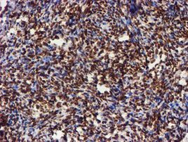 CYP17A1 Antibody in Immunohistochemistry (Paraffin) (IHC (P))