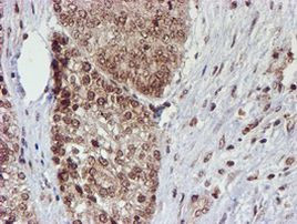 CYP17A1 Antibody in Immunohistochemistry (Paraffin) (IHC (P))