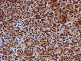 CYP17A1 Antibody in Immunohistochemistry (Paraffin) (IHC (P))