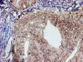 CYP17A1 Antibody in Immunohistochemistry (Paraffin) (IHC (P))