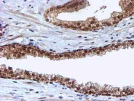 CYP17A1 Antibody in Immunohistochemistry (Paraffin) (IHC (P))