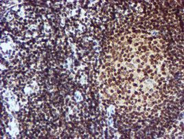 CYP17A1 Antibody in Immunohistochemistry (Paraffin) (IHC (P))