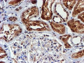 CYP17A1 Antibody in Immunohistochemistry (Paraffin) (IHC (P))