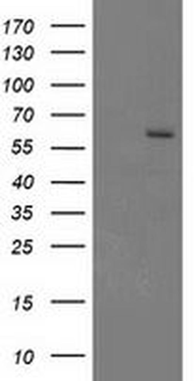 CYP17A1 Antibody in Western Blot (WB)