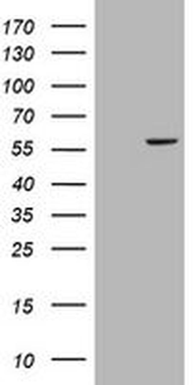 CYP17A1 Antibody in Western Blot (WB)