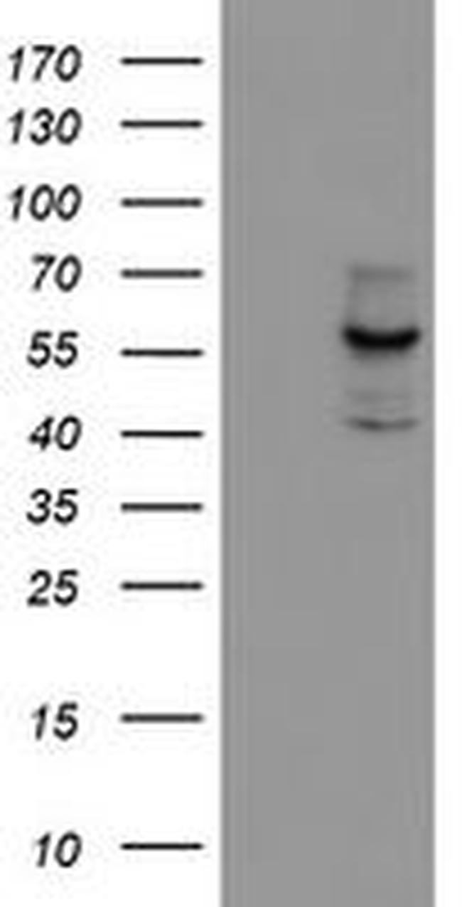 CYP17A1 Antibody in Western Blot (WB)