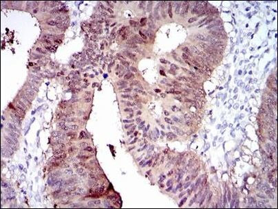 CYP1A1 Antibody in Immunohistochemistry (Paraffin) (IHC (P))