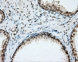 CYP1A2 Antibody in Immunohistochemistry (Paraffin) (IHC (P))