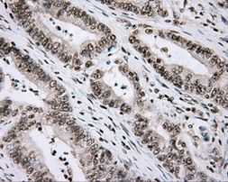 CYP1A2 Antibody in Immunohistochemistry (Paraffin) (IHC (P))