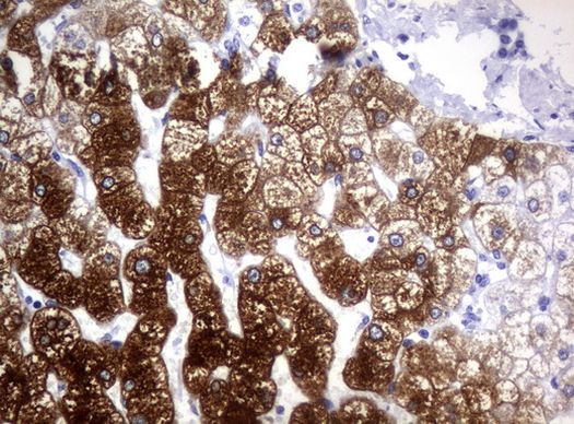 CYP1A2 Antibody in Immunohistochemistry (Paraffin) (IHC (P))