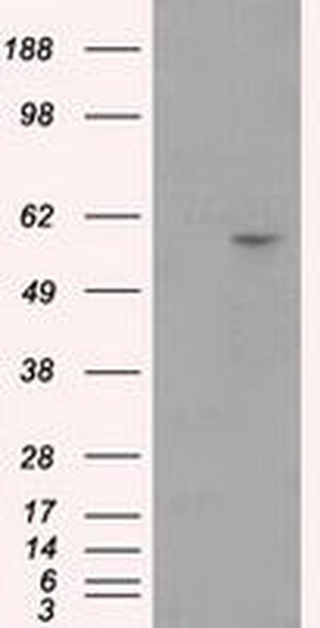 CYP1A2 Antibody in Western Blot (WB)