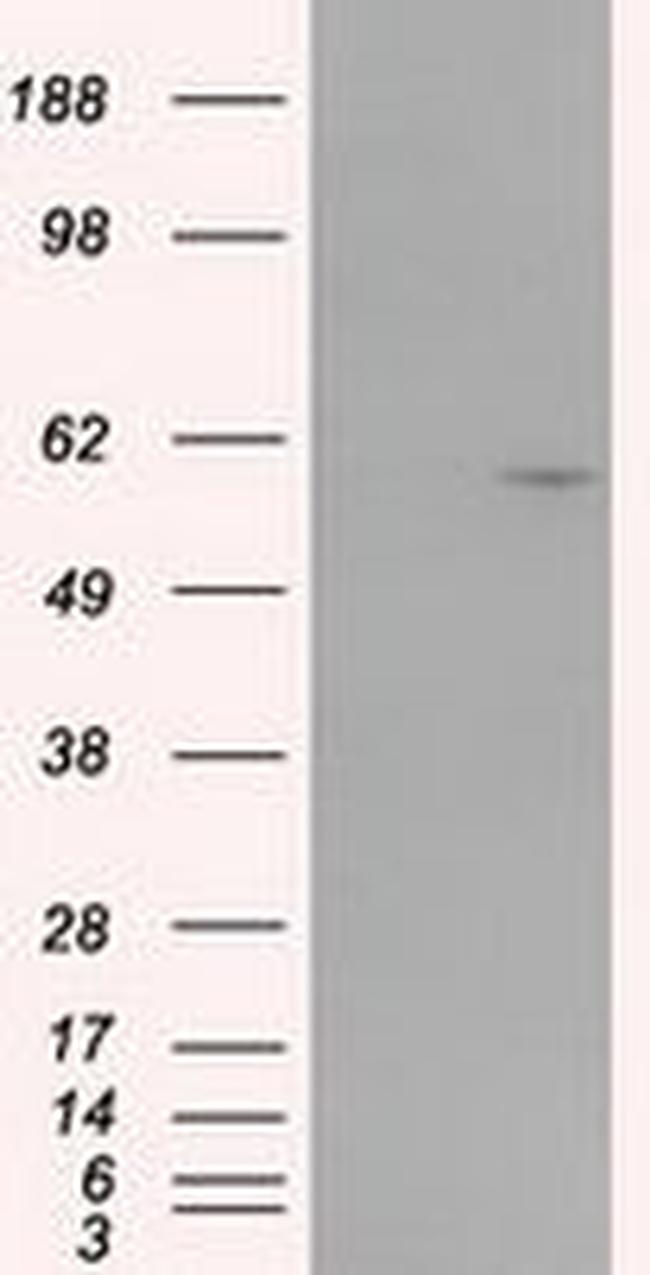 CYP1A2 Antibody in Western Blot (WB)