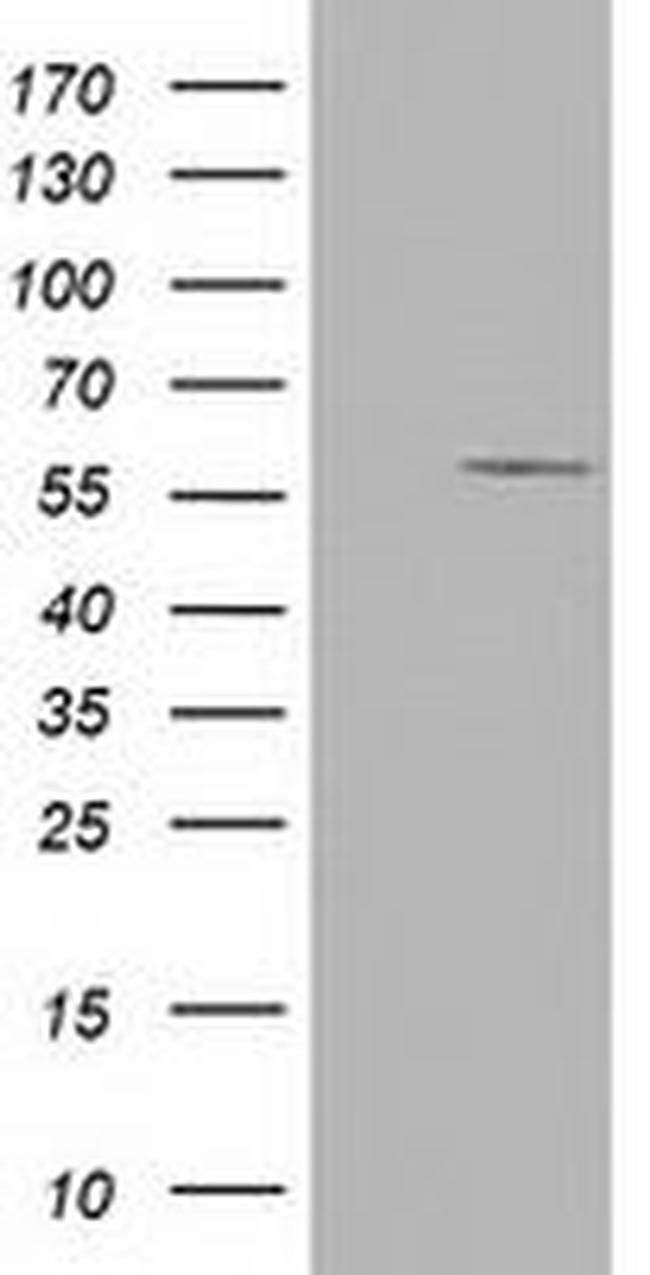 CYP1A2 Antibody in Western Blot (WB)