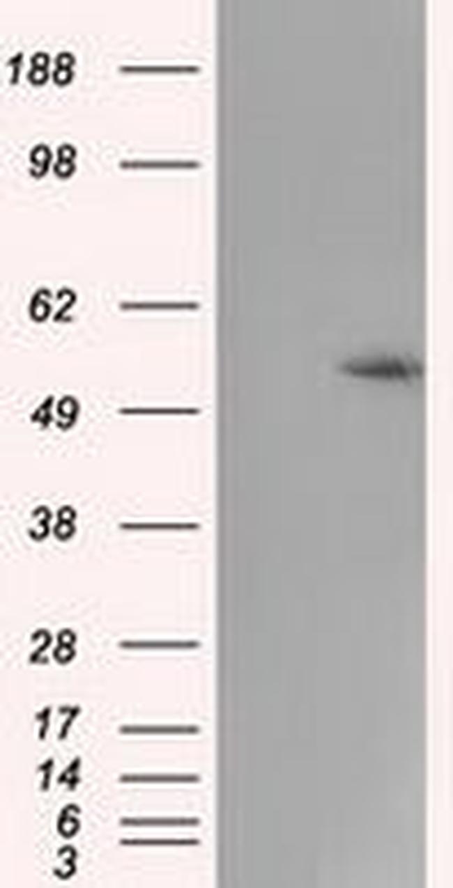 CYP1A2 Antibody in Western Blot (WB)