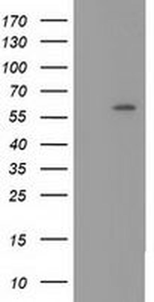 CYP1A2 Antibody in Western Blot (WB)