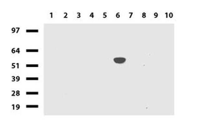 CYP1A2 Antibody in Western Blot (WB)