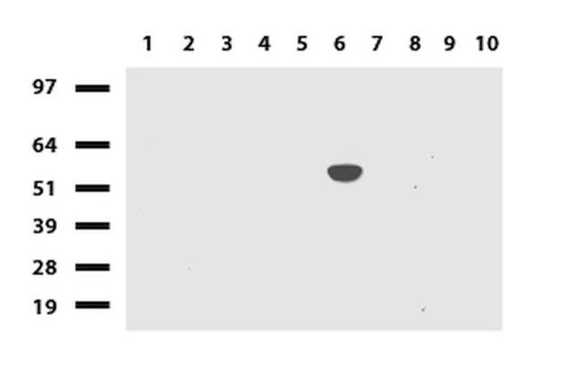 CYP1A2 Antibody in Western Blot (WB)