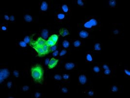 CYP2A6 Antibody in Immunocytochemistry (ICC/IF)