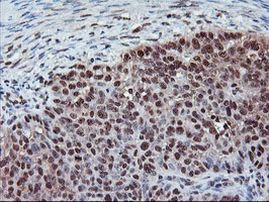 CYP2A6 Antibody in Immunohistochemistry (Paraffin) (IHC (P))