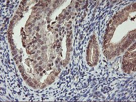 CYP2A6 Antibody in Immunohistochemistry (Paraffin) (IHC (P))