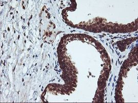 CYP2A6 Antibody in Immunohistochemistry (Paraffin) (IHC (P))