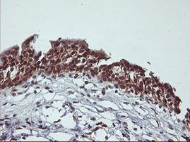 CYP2A6 Antibody in Immunohistochemistry (Paraffin) (IHC (P))