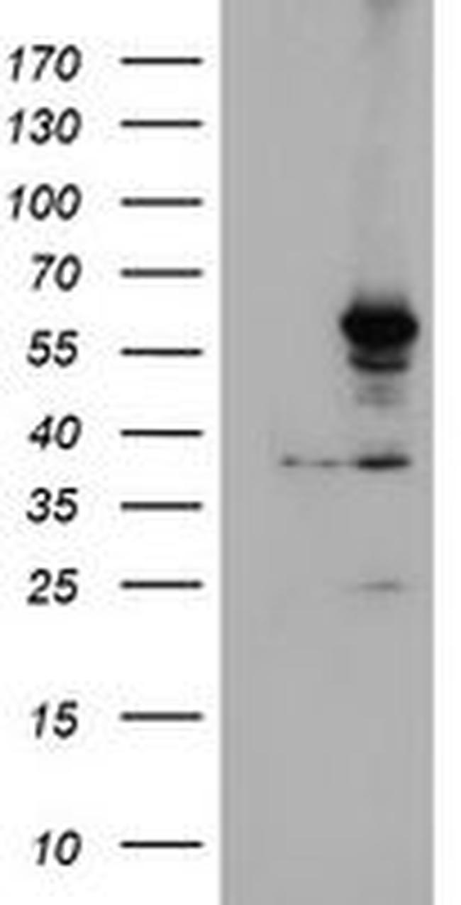 CYP2A6 Antibody in Western Blot (WB)