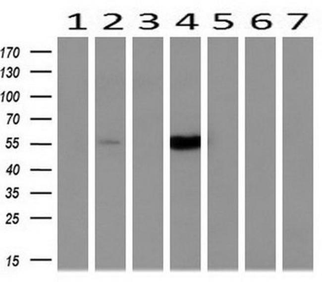 CYP2A6 Antibody in Western Blot (WB)