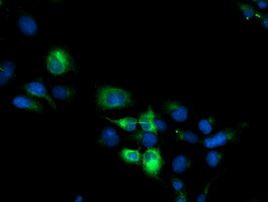 CYP2B6 Antibody in Immunocytochemistry (ICC/IF)