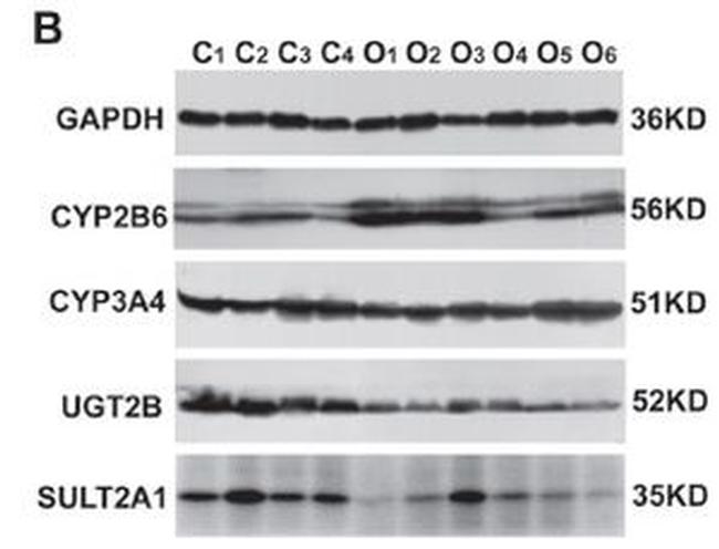 CYP2B6 Antibody in Western Blot (WB)
