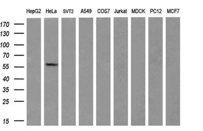 CYP2C9 Antibody in Western Blot (WB)