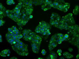 CYP2E1 Antibody in Immunocytochemistry (ICC/IF)