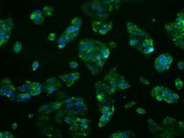 CYP2E1 Antibody in Immunocytochemistry (ICC/IF)