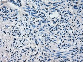 CYP2E1 Antibody in Immunohistochemistry (Paraffin) (IHC (P))