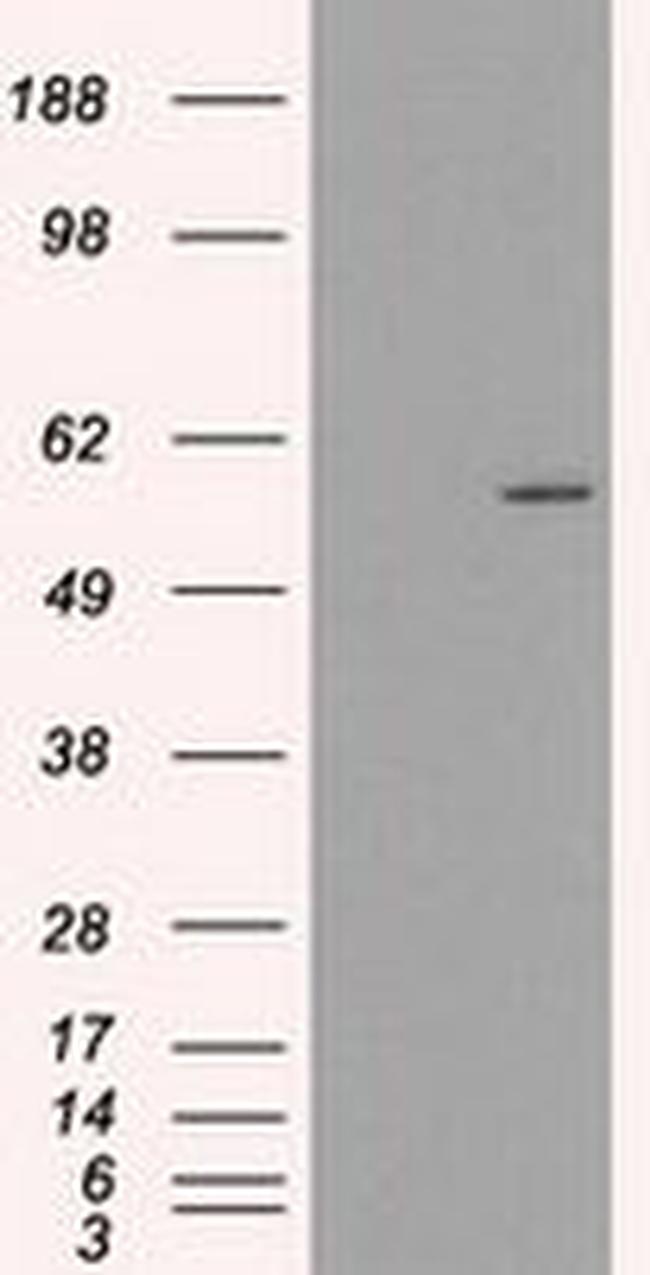 CYP2E1 Antibody in Western Blot (WB)