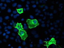 CYP2J2 Antibody in Immunocytochemistry (ICC/IF)