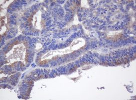 CYP2J2 Antibody in Immunohistochemistry (Paraffin) (IHC (P))