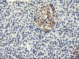 CYP2J2 Antibody in Immunohistochemistry (Paraffin) (IHC (P))