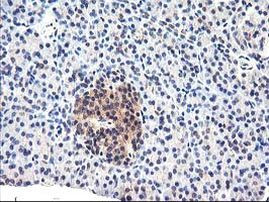 CYP2J2 Antibody in Immunohistochemistry (Paraffin) (IHC (P))