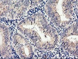 CYP2J2 Antibody in Immunohistochemistry (Paraffin) (IHC (P))