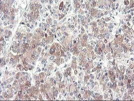 CYP2J2 Antibody in Immunohistochemistry (Paraffin) (IHC (P))