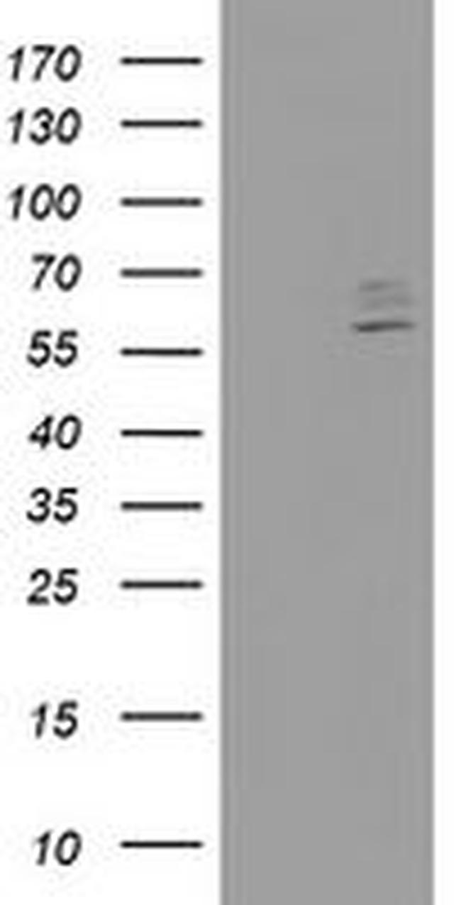 CYP2J2 Antibody in Western Blot (WB)